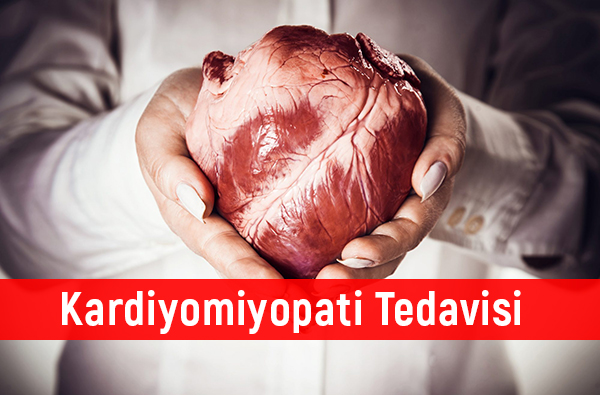 Kardiyomiyopati Tedavisi