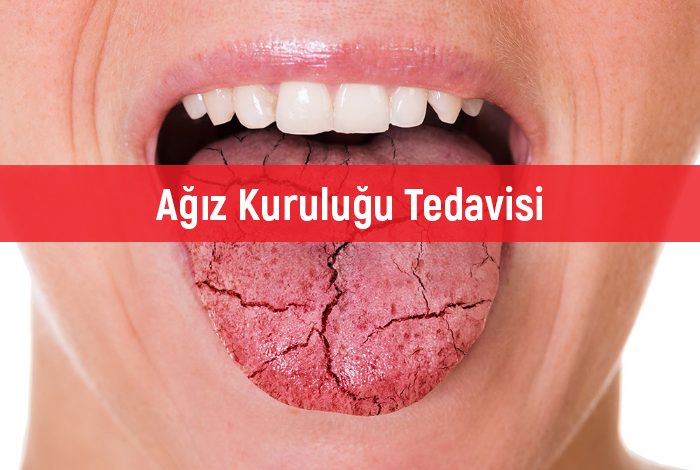 Ağız Kuruluğu Nedenleri