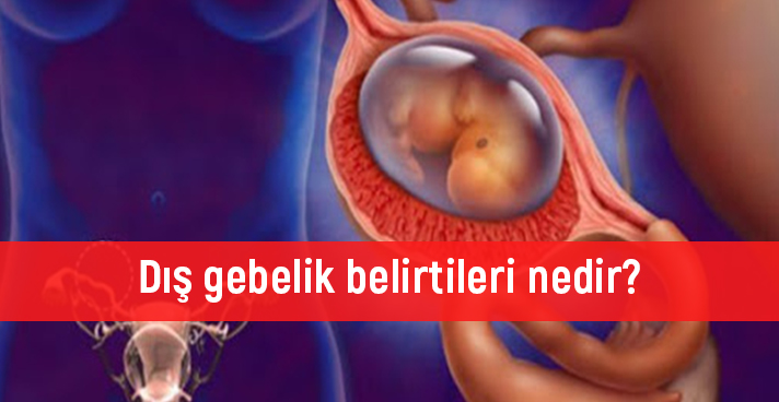 Dış gebelik nedir? Dış gebelik belirtileri nedir?