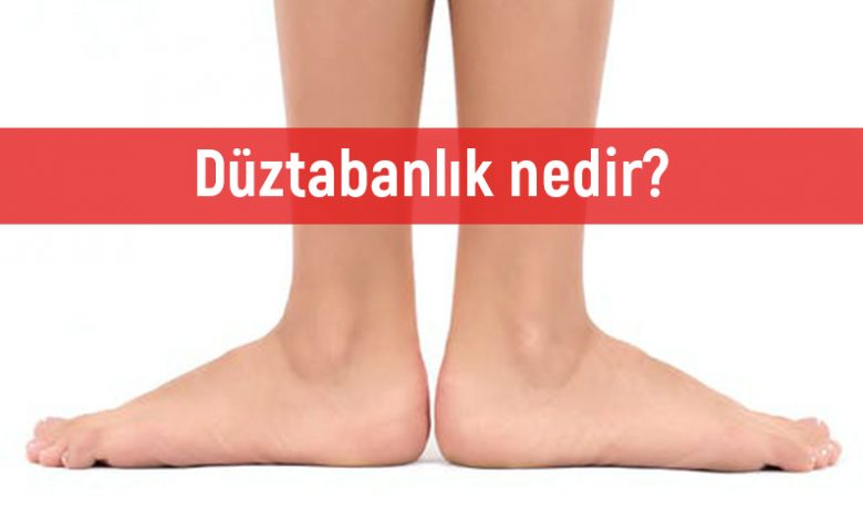 Düztabanlık (Taban Çökmesi) Nedir? Nasıl Tedavi Edilir?