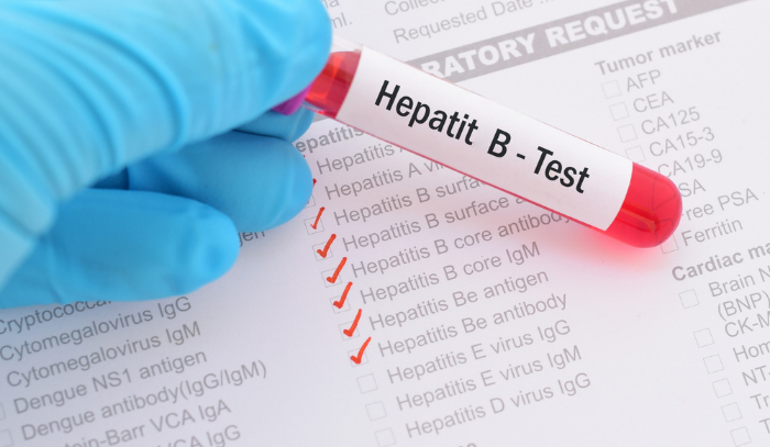 Hepatit B, Risk Faktörleri Ve Belirtileri ‣ Tedavi.tc