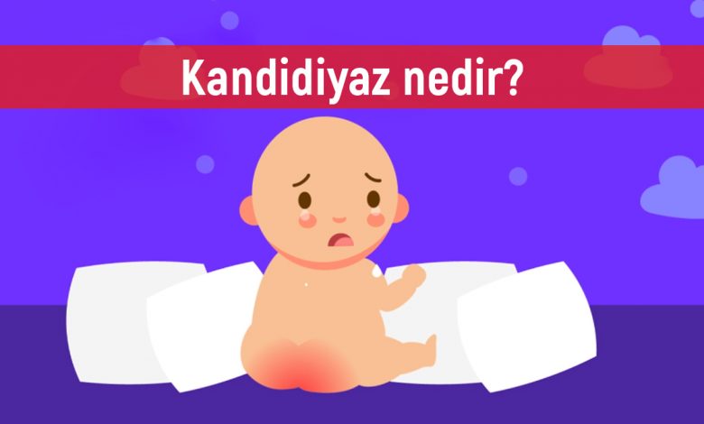 Kandidiyaz nedir? Belirtileri ve tedavi yöntemleri nelerdir?