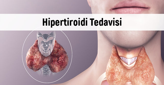 Hipertiroidi Nedenleri, Belirtileri ve Tedavisi