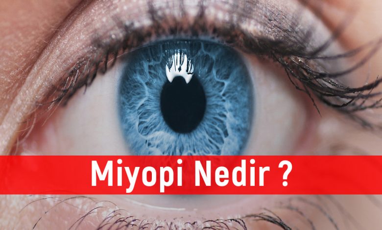 Miyopi Nedir ?