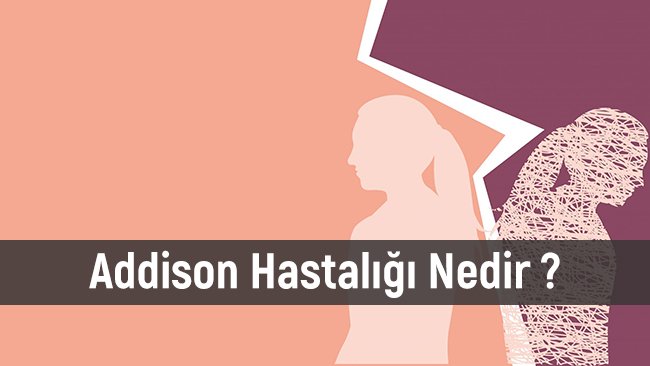 Addison Hastalığı Nedir ? Tedavisi Nasıl Yapılır ?