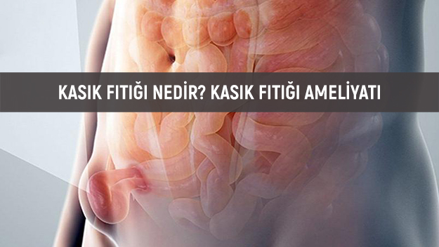 KASIK FITIĞI NEDİR? KASIK FITIĞI AMELİYATI