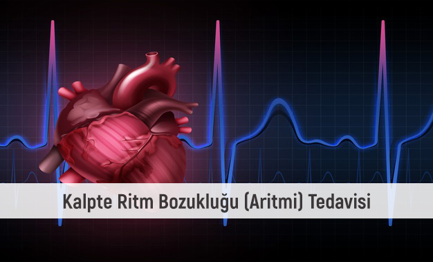 Kalpte Ritm Bozukluğu (Aritmi) Belirtisi ve Tedavisi