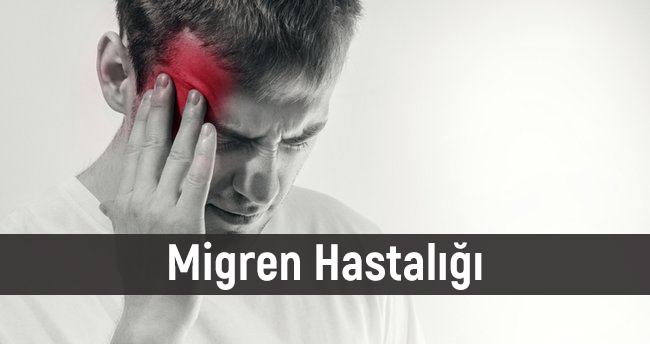 Migren Hastalığı, Migren Tedavisi