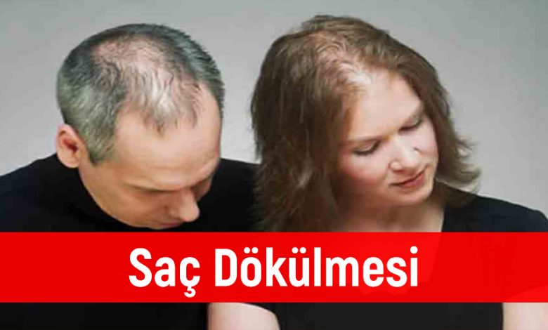 Saç Dökülmesi Nedenleri ve Çözümü ?